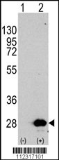HSPB1 Antibody