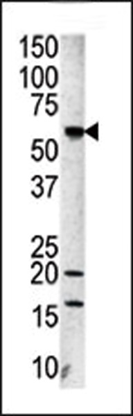 Aurora-A Antibody