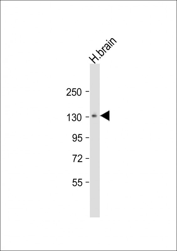 Metabotropic Glutamate Receptor 1 Antibody
