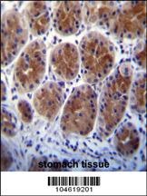Metabotropic Glutamate Receptor 1 Antibody