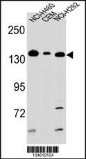 Metabotropic Glutamate Receptor 1 Antibody