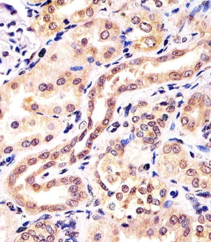 KCTD11 Antibody