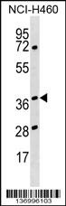 HNRNPH3 Antibody