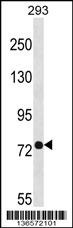 PHEX Antibody