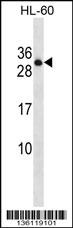 PTPRCAP Antibody