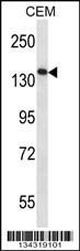 AATK Antibody