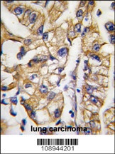 HDBP1 Antibody