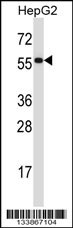 PDIA2 Antibody