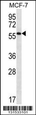 SAAL1 Antibody