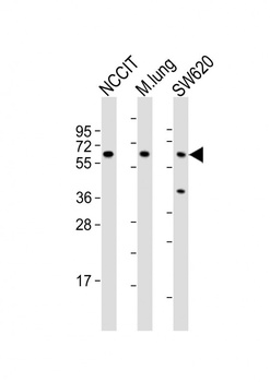 TGFBR2 Antibody