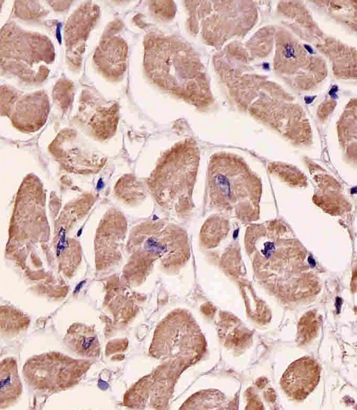 SPHK1 Antibody