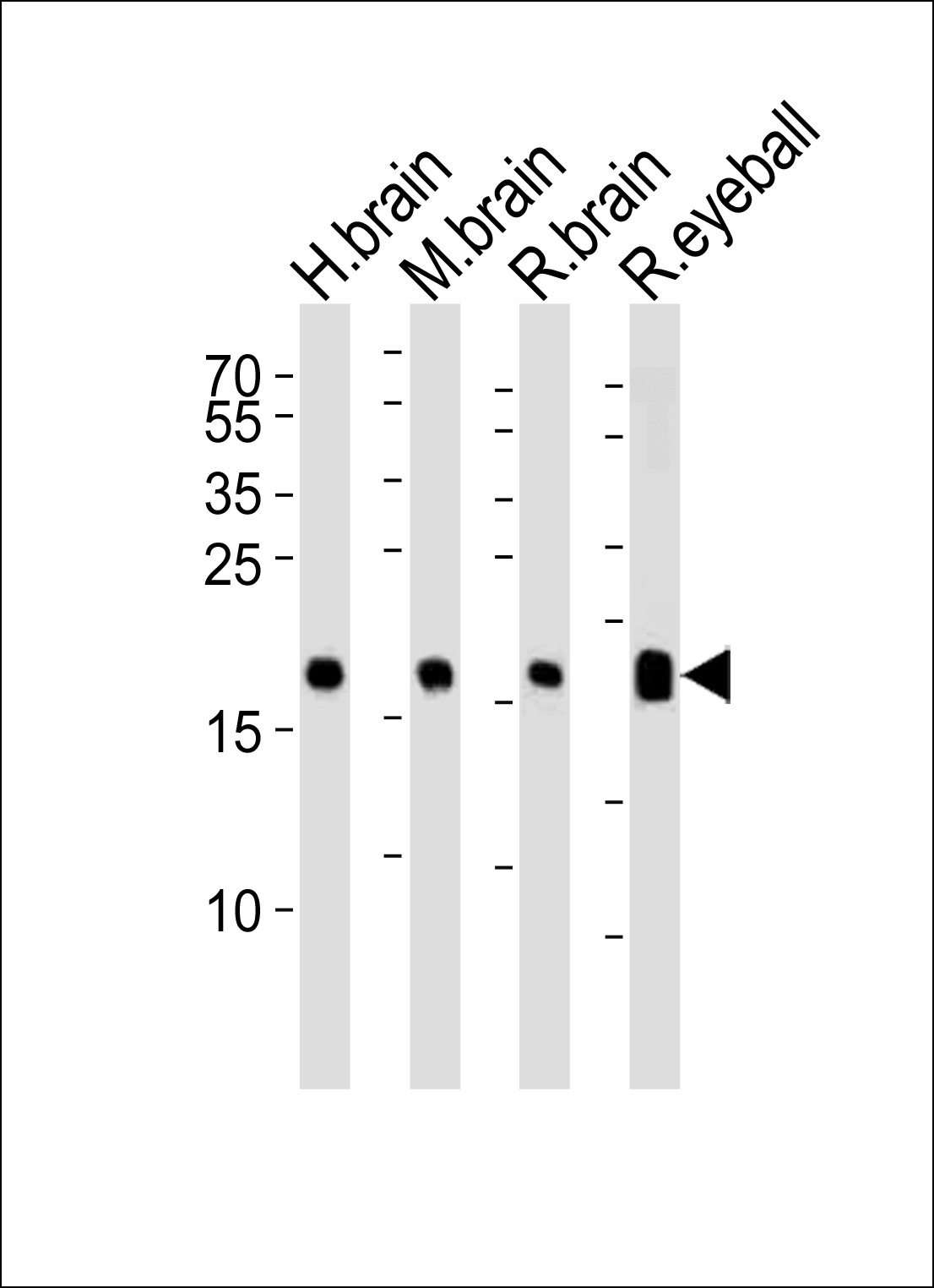 VILIP1 Antibody