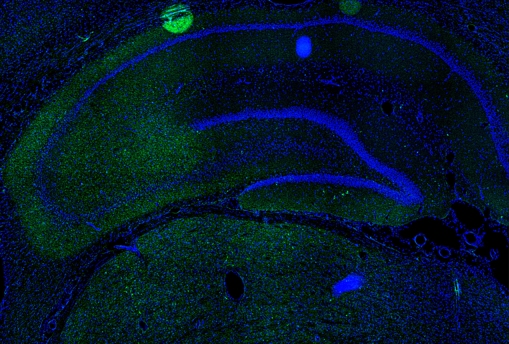 IL-1a Antibody