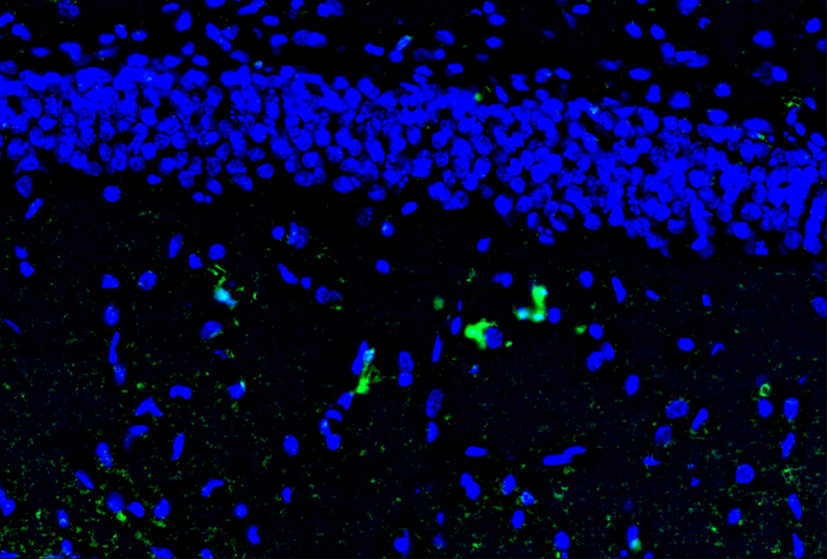 IL-1a Antibody