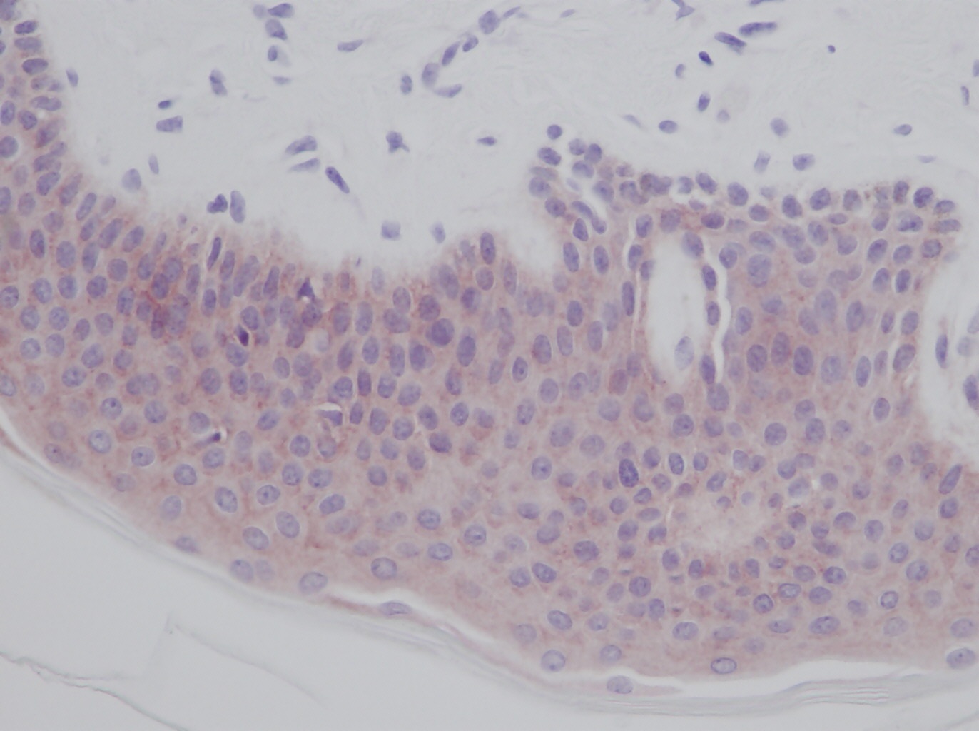IL-1a Antibody