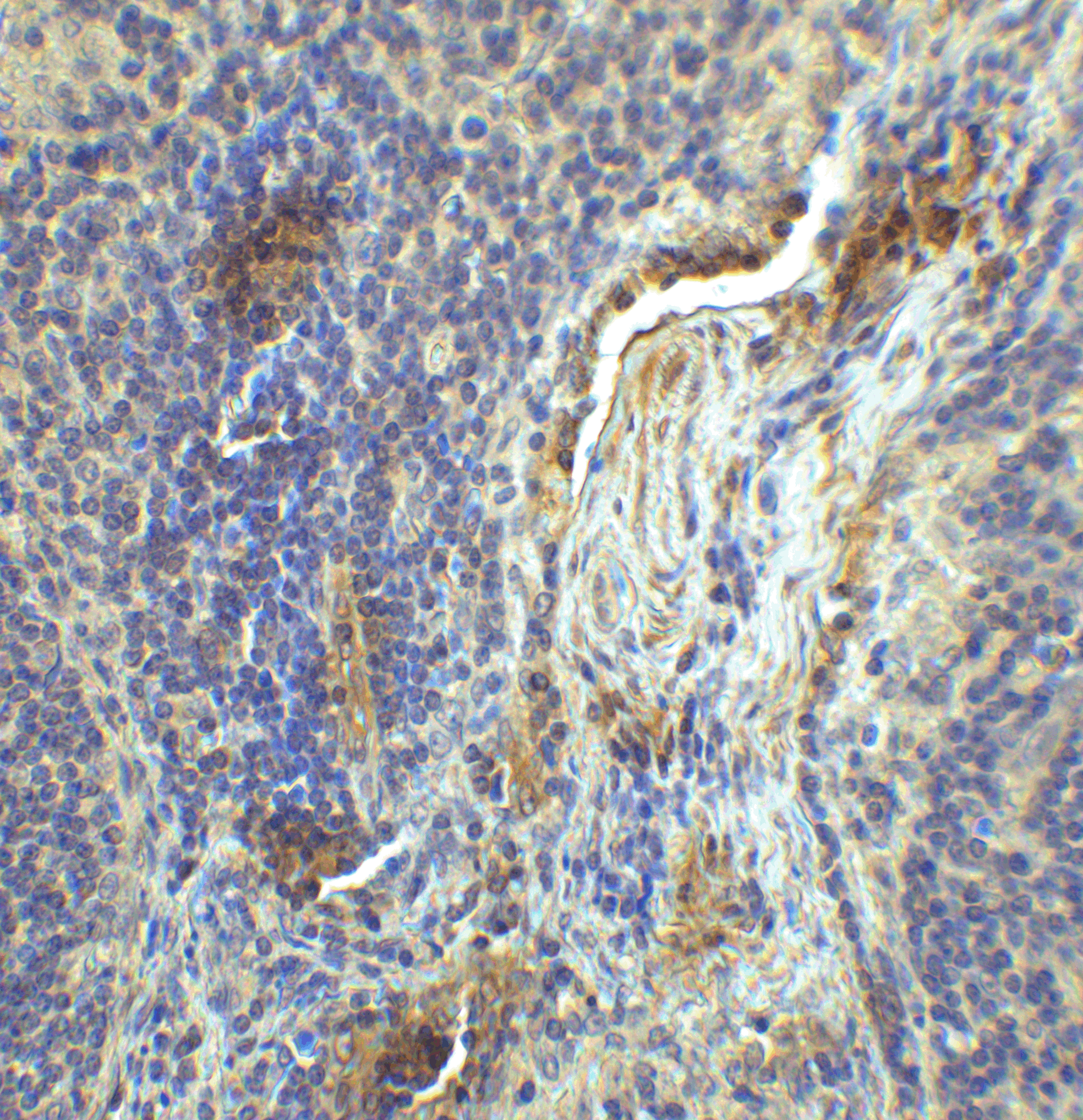 LAG-3 Single Domain Antibody [2B11]
