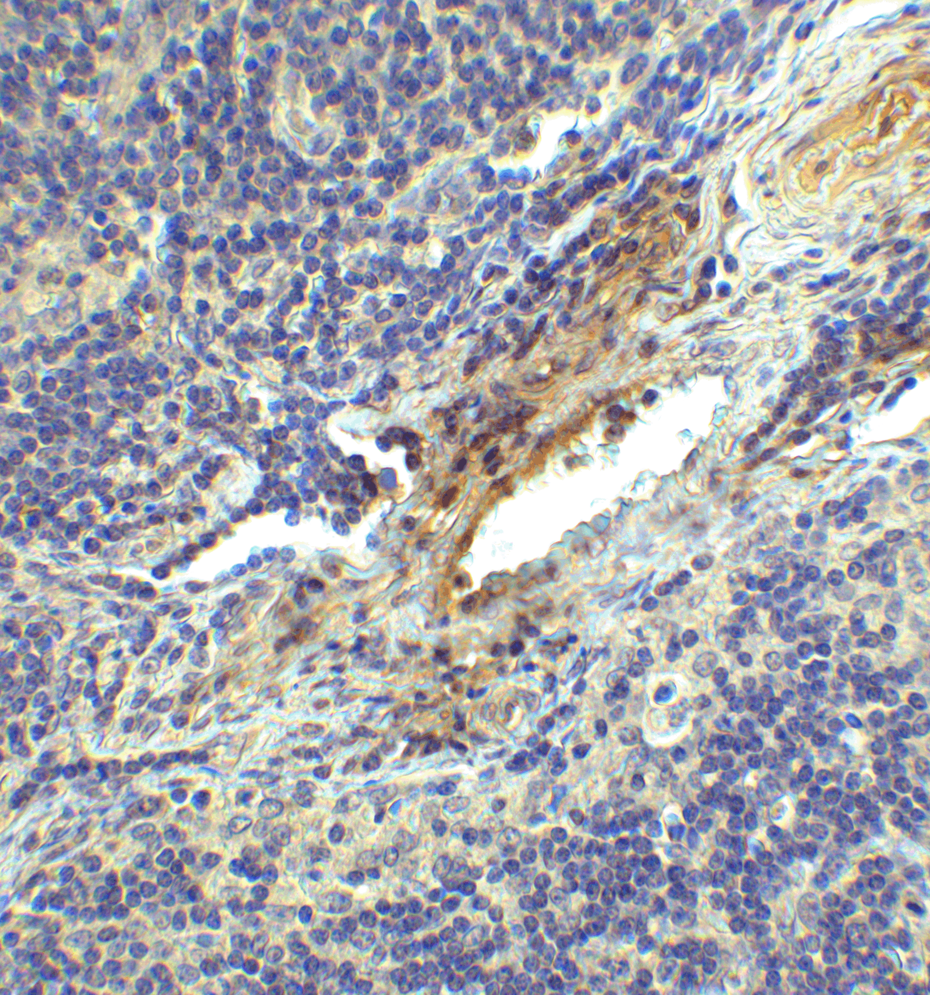 LAG-3 Single Domain Antibody [2A11]