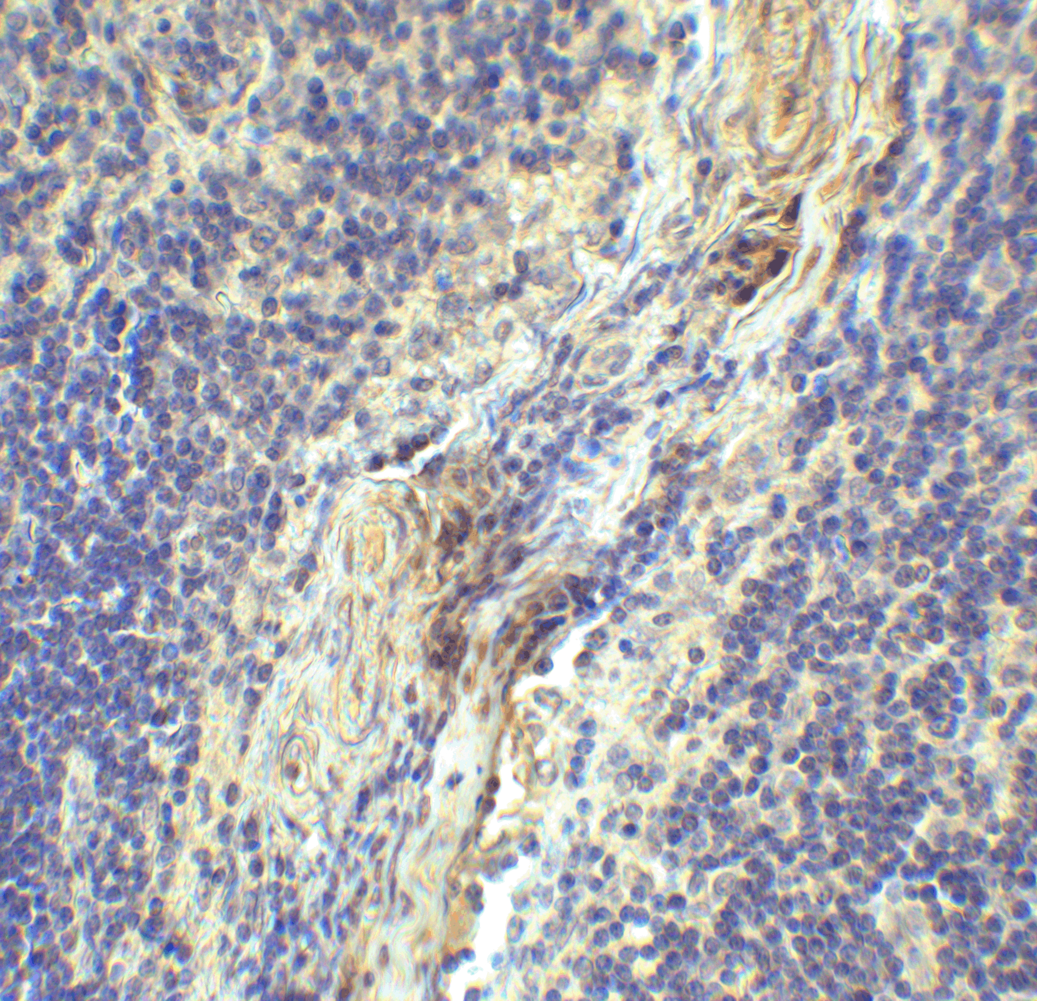 LAG-3 Single Domain Antibody [1A6]