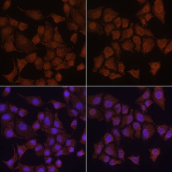 LC3B Antibody, KO Validated