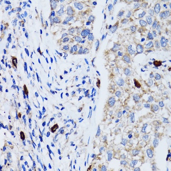 LC3B Antibody, KO Validated