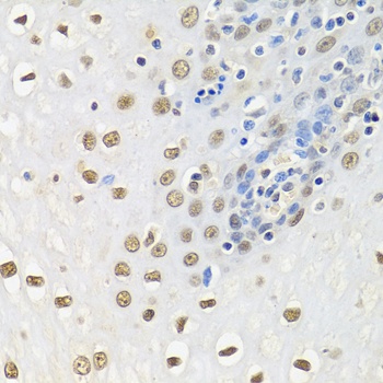 HuR / ELAVL1 Antibody, KO Validated