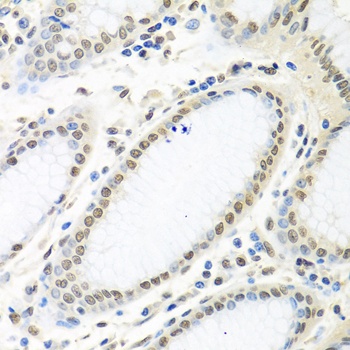 HuR / ELAVL1 Antibody, KO Validated