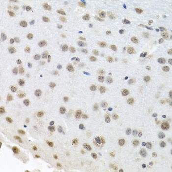 HuR / ELAVL1 Antibody, KO Validated