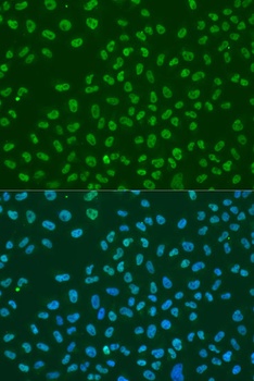 HuR / ELAVL1 Antibody, KO Validated