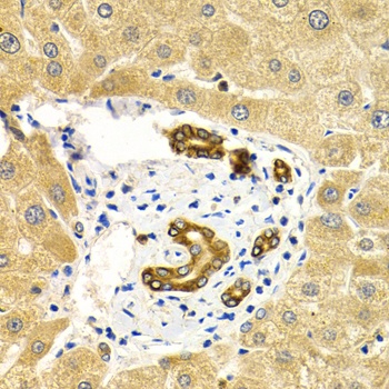 RAB27A Antibody, KO Validated