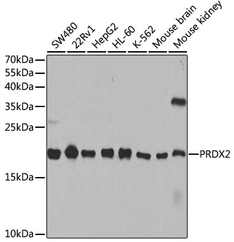 PRDX2 Antibody, KO Validated