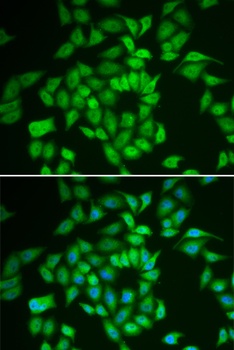 CSNK1E Antibody, KO Validated