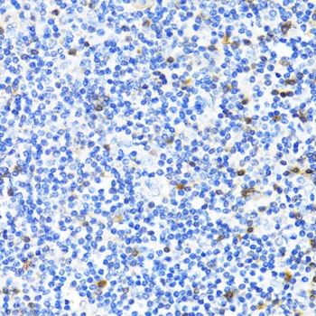 S100A4 Antibody, KO Validated