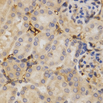 HuR / ELAVL1 Antibody, KO Validated