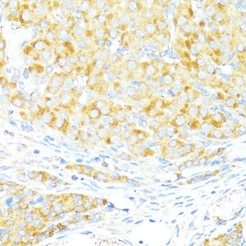 BAX Antibody, KO Validated