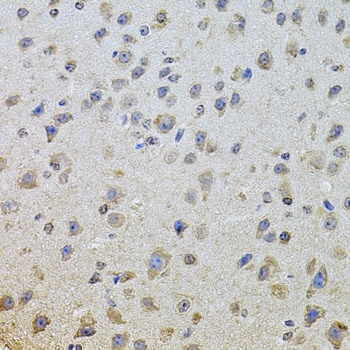 EGFR Antibody, KO Validated