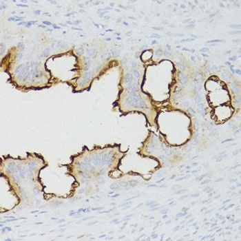 EGFR Antibody, KO Validated