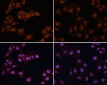 LC3B Antibody, KO Validated