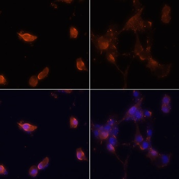 LC3B Antibody, KO Validated