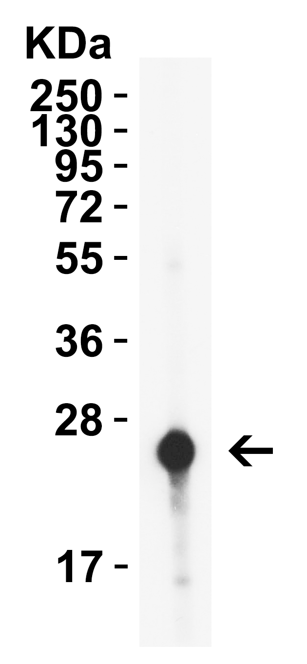 HIV-1 p24 Antibody [10A2]