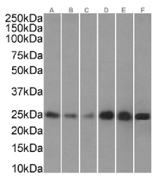 CBX5 Antibody [RAB-C133], Rabbit IgG