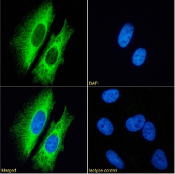 Cytokeratin 7 Antibody [OV-TL 12/30], Rabbit IgG