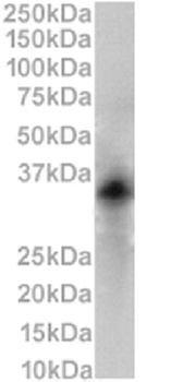 CD79b Antibody [HM79-16], Rabbit IgG