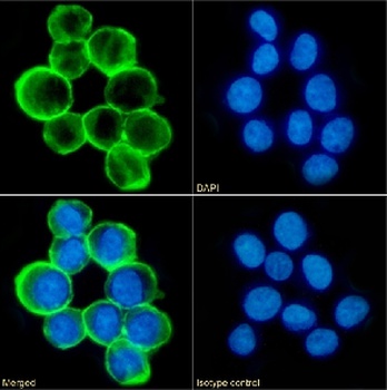 CD43 Antibody [84-3C1], Rabbit IgG