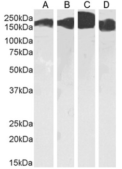CD171 Antibody [L1-14.10], Mouse IgG1
