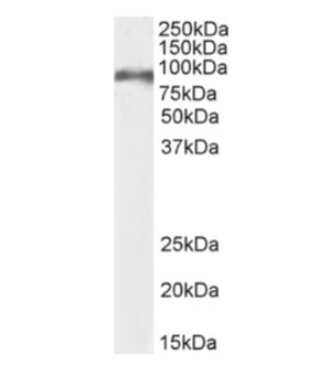 CD155 Antibody [3F1], Rabbit IgG