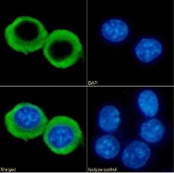 CCRL2 Antibody [BZ5B8], Rabbit IgG
