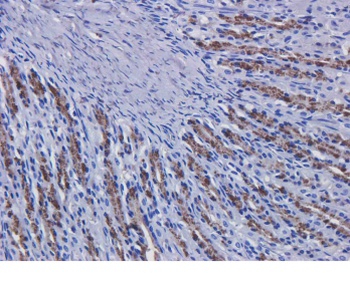 EGFR Antibody [Matuzumab], Human IgG1 - Research Grade Biosimilar