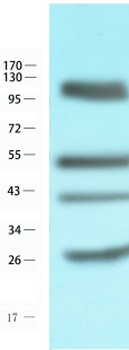 CD4 Antibody [CE9.1 (Clenoliximab)], Human IgG4 - Research Grade Biosimilar