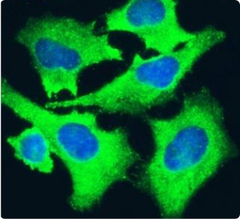 alpha 5 beta 1 Integrin Antibody [M200 (Volociximab)], Rabbit IgG - Research Grade Biosimilar