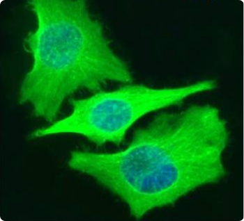 Beta-Tubulin Antibody [S11B], Rabbit IgG